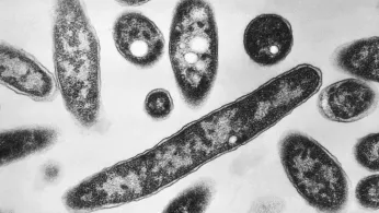 What to Know About Legionnaires' Disease, Which Has Sickened Dozens in New York City